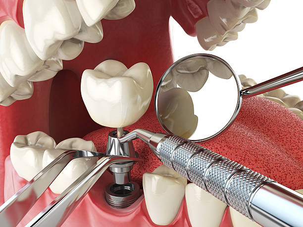 Best Emergency Tooth Extraction  in Dorothy, NJ